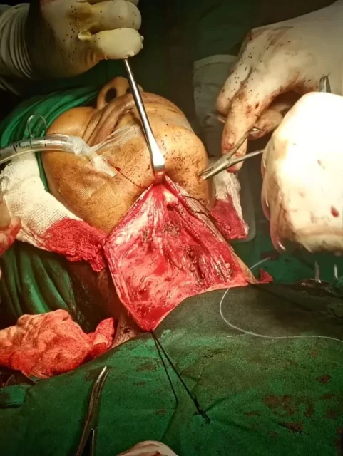 Head & neck surgery