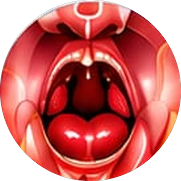 Tonsillectomy